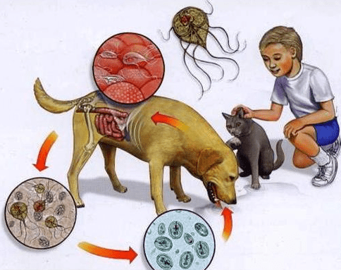 Symptômes de l'infection à la Lamblia