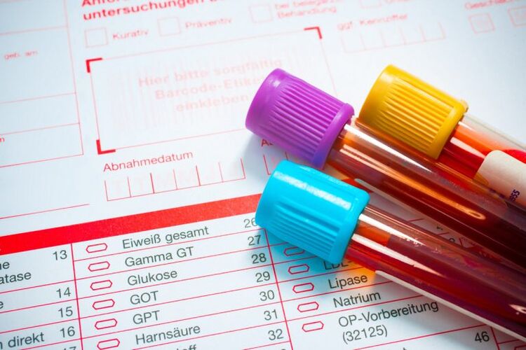 Blood pour la recherche sur les parasites